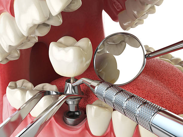 Best Emergency Pediatric Dental Care in London, CA