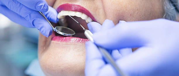  London, CA Emergency Dentist Pros