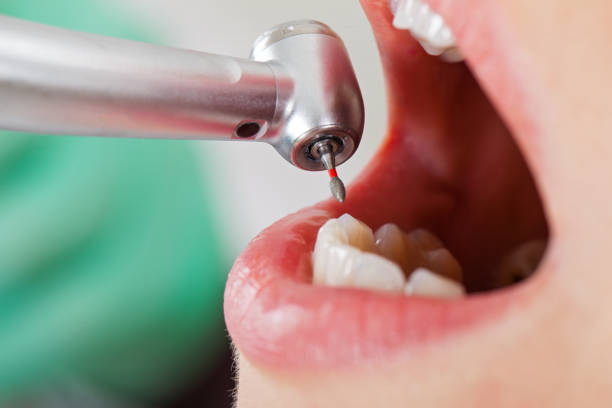 Best Weekend Emergency Dental Services in London, CA